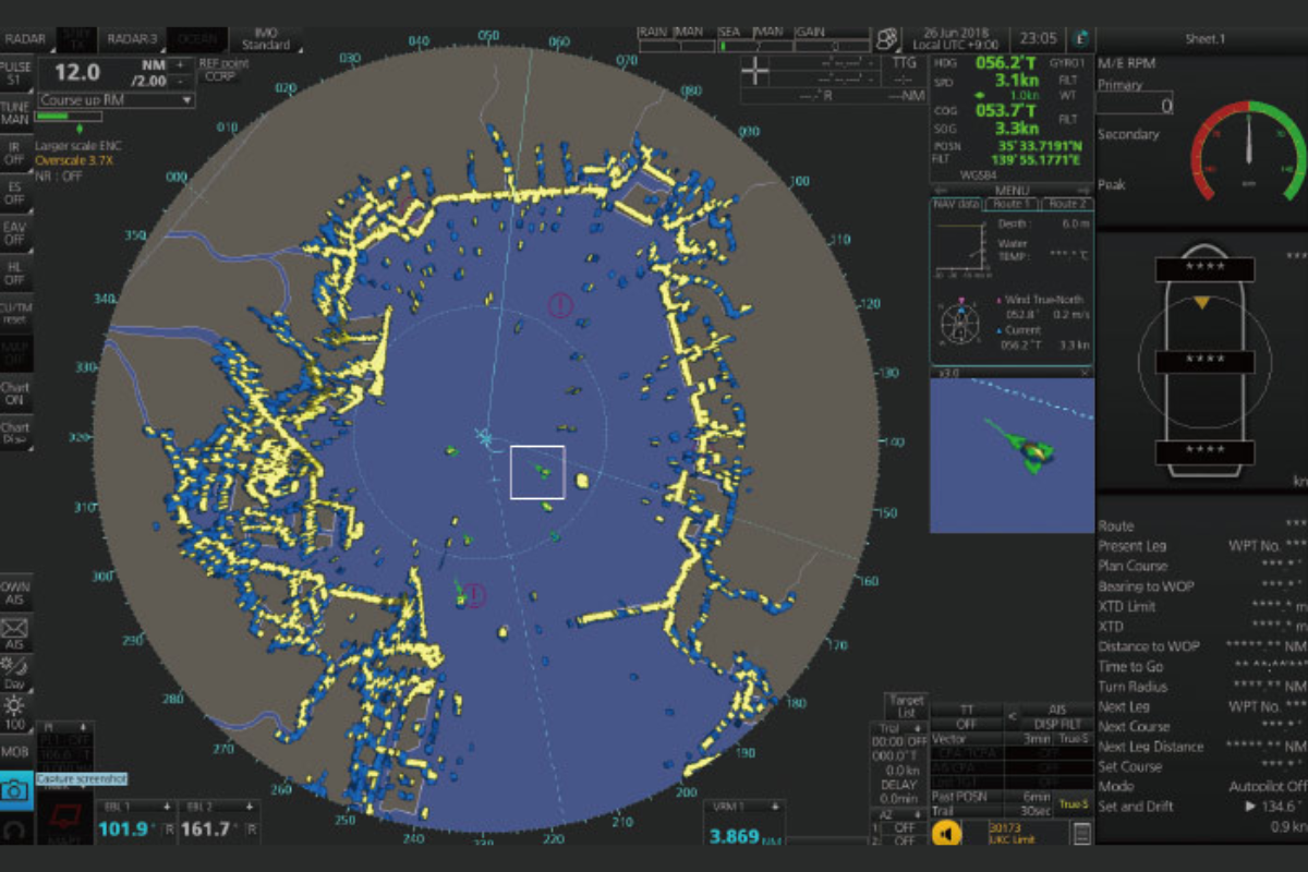 Radar
